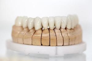 placca dentale in porcellana di zirconio foto