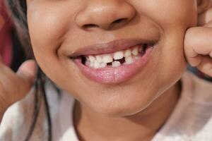 dettaglio tiro di bambino con denti mancante foto