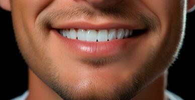 maschio Sorridi avvicinamento, bianco come la neve denti, cosmetologia concetto, odontoiatria - ai generato Immagine foto