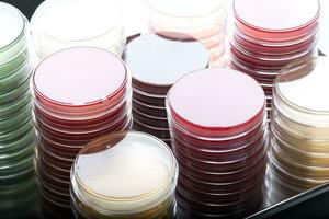rosso e giallo petri piatti pile nel microbiologia laboratorio su il batteriologia laboratorio sfondo. foto