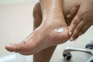 asiatico donna cura piedi con Cracked e asciutto tacco pelle crema a casa. foto