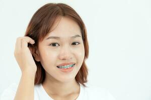 trattamento. dentale cura. bellissimo asiatico donna salutare smile.metal parentesi su denti. giovane femmina Sorridi con bretelle e mostrare bellissimo di denti, cura dopo bretelle, fiducioso nel ortodonzia foto