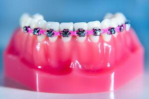 bretelle siamo posto su il denti nel il artificiale mascella contro un' leggero blu sfondo. macro fotografia foto