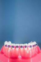 bretelle siamo posto su il denti nel il artificiale mascella contro un' leggero blu sfondo. macro fotografia foto