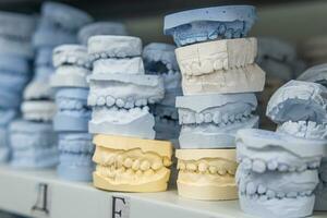 magazzino di gesso Modelli di umano fauci nel un ortodontico clinica. controllo e diagnostico dentale calchi per allineatori. foto