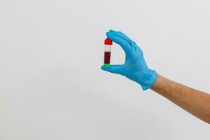 mano Tenere sangue nel test tubo vicino su foto