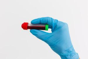 mano Tenere sangue nel test tubo vicino su foto