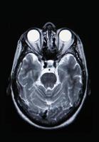 una vera risonanza magnetica del sistema vascolare cerebrale foto