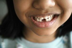 dettaglio tiro di bambino con denti mancante foto