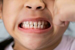 colpo alla testa ritagliata Immagine di carino prescolastico ragazza sorridente largo mostrando latte denti. avvicinamento di un' del bambino bianca denti. foto