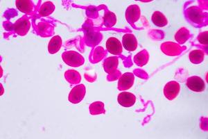 hemerocallis citrina antera matura al microscopio - punti rosa astratti su sfondo bianco foto