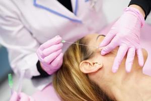 medico che inietta fili di trattamento di sutura pdo nel volto di una donna. foto