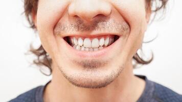 vicino su ritratto Sorridi denti uomo. bianca bellissimo denti dopo sbiancante, allineamento foto