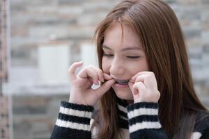ritratto di adolescenziale ragazze con bretelle su sua denti foto