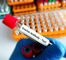 ovarico anticorpo test per diagnosticare femmina infertilità come bene come durante e dopo il infertilità trattamento. foto