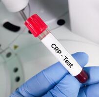 sangue campione per crp o c reattivo proteina test Usato per identificare infiammazione o infezione nel il corpo foto