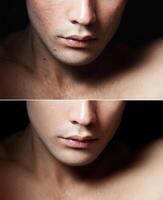 prima e dopo cosmetico operazione. giovane uomo ritratto foto