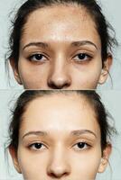 prima e dopo cosmetico operazione. foto