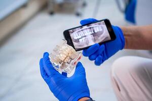 artificiale plastica mascella con dentale impianti per formazione nel medico mani. mostrando curare metodi. confrontando con raggi X. avvicinamento. foto