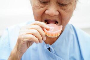 asiatico anziano donna paziente Tenere denti dentiera nel sua mano per masticare cibo. foto