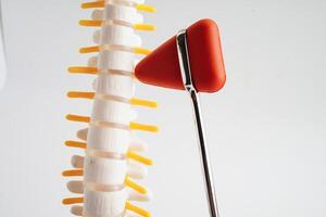 spinale nervo e osso con ginocchio riflesso martello, lombare colonna vertebrale sfollati ernia disco frammento, modello per trattamento medico nel il ortopedico Dipartimento. foto