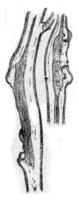 longitudinale taglio Mela rami con ferite dovuto per cancro, Vintage ▾ incisione. foto
