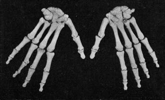 scheletro di un' umano mano visto a partire dal il fuori, Vintage ▾ incisione. foto