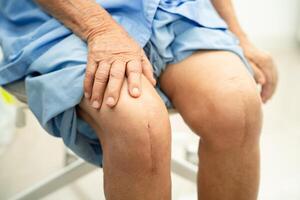 asiatico anziano donna paziente mostrare sua cicatrici chirurgico totale ginocchio comune sostituzione suturare ferita chirurgia artroplastica su letto nel Ospedale. foto