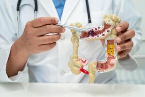 intestino, appendice e digestivo sistema, medico Tenere anatomia modello per studia diagnosi e trattamento nel Ospedale. foto