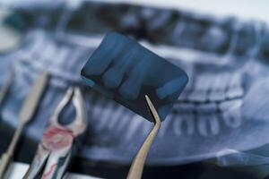 dentiera e dentale strumenti. panoramico mascella raggi X. individuale dentale trattamento. metallo stomatologia strumenti. foto
