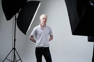 albinismo albino uomo nel studio vestito maglietta isolato su un' bianca sfondo. anormale deviazioni. insolito aspetto foto