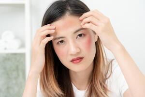 giovane donna siamo preoccupato di facce dermatologia e allergico per steroidi nel cosmetici. sensibile pelle, rosso viso a partire dal scottature, acne, allergico per sostanze chimiche, eruzione cutanea su viso. pelle i problemi e bellezza foto