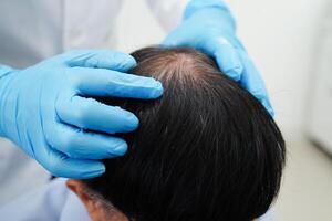 medico toccare grassetto testa nel uomo, capelli perdita trattamento Salute problema. foto