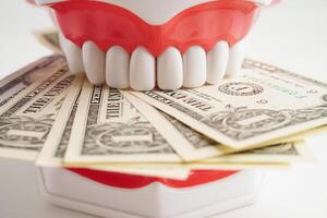trattamento dentale cura costo, dentale spese o tassa, noi dollaro banconota i soldi con denti modello. foto