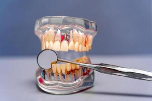 plastica modello di il mascella per protesi nel odontoiatria e maxillofacciale chirurgia bugie su un' bianca tavolo con dentale specchio. foto
