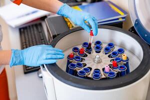 ottenere pronto. vicino su di umano mani mettendo il test tubi per centrifuga. laboratorio concetto. foto