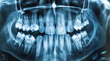 un' avvicinamento di un' dentale raggi X Immagine essere valutato di ai Software per segni di presto dente decadimento o gomma malattia foto