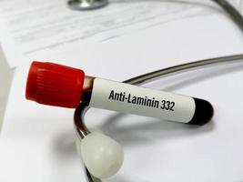 campione di sangue per il test anti-laminina 332. anticorpo zona membrana