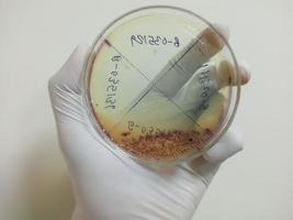 scienziato o tecnologo tiene in laboratorio una piastra per terreni di coltura. capsula di Petri di urinocoltura in microbiologia. avvicinamento. e. coli foto