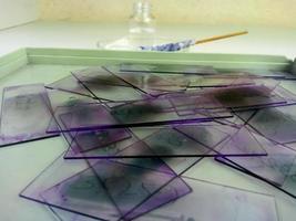 vetrini colorati di striscio di sangue periferico con macchia viola di leishman giemsa è isolato nel reparto di ematologia che è pronto per l'esame microscopico foto