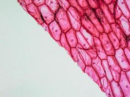 microfotografia dell'epidermide di cipolla foto