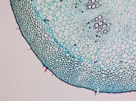micrografia di cellule di gelso foto