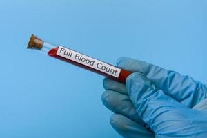 mano che tiene un test per un esame del sangue completo in una provetta su sfondo blu. foto