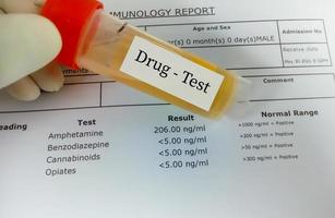 il tecnico tiene un campione di urina per il test antidroga. test antidroga è l'analisi tecnica di un campione per determinare l'abuso di droghe illegali come benzodiazepine, cannabis, anfetamine, oppiacei. foto