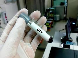 il tecnico o lo scienziato tengono una provetta del test di tolleranza al glucosio o gtt foto