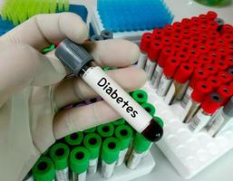 campione di sangue per test del diabete, diagnosi di iperglicemia o ipoglicemia. foto
