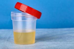 nuovo contenitore di plastica con analisi delle urine foto