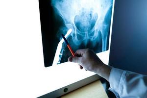 un radiologo esamina in primo piano una radiografia dell'articolazione dell'anca foto