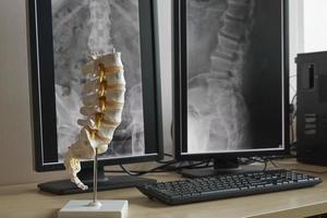 modello della colonna vertebrale lombare umana e sfondo della colonna vertebrale lombare dei raggi X foto