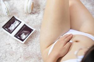 donna incinta che tiene l'immagine ad ultrasuoni concetto di gravidanza foto